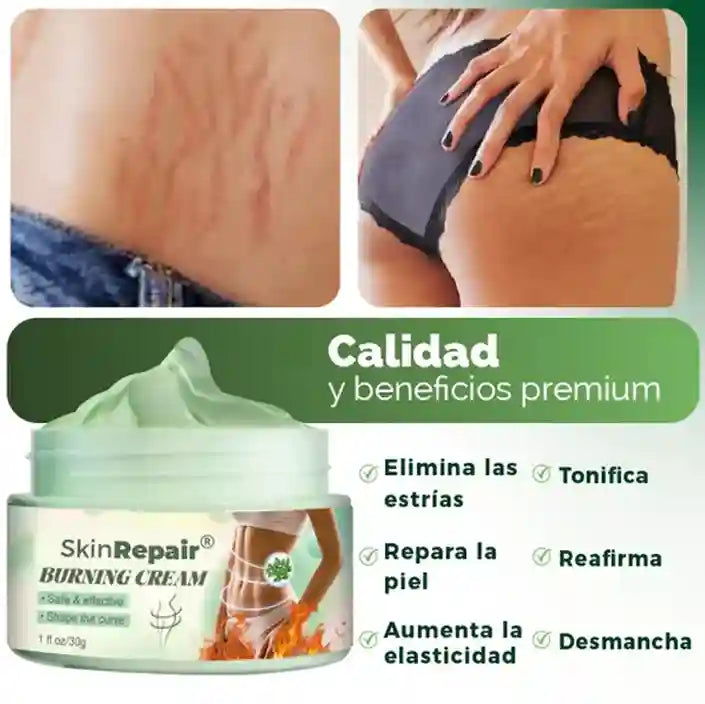 Crema Anti-estrias GoldBox