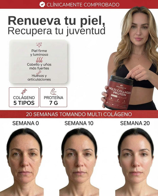 Multi Colágeno - Fórmula Avanzada de 5 Tipos Wholesome Wellness